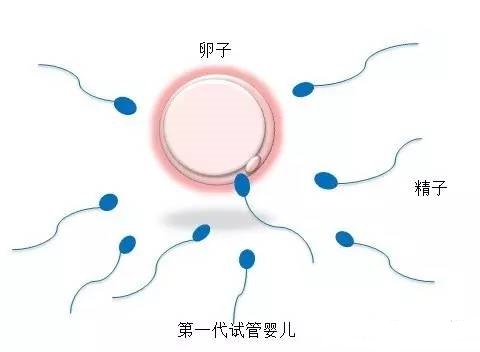 人工同志借卵代怀服务怎么找